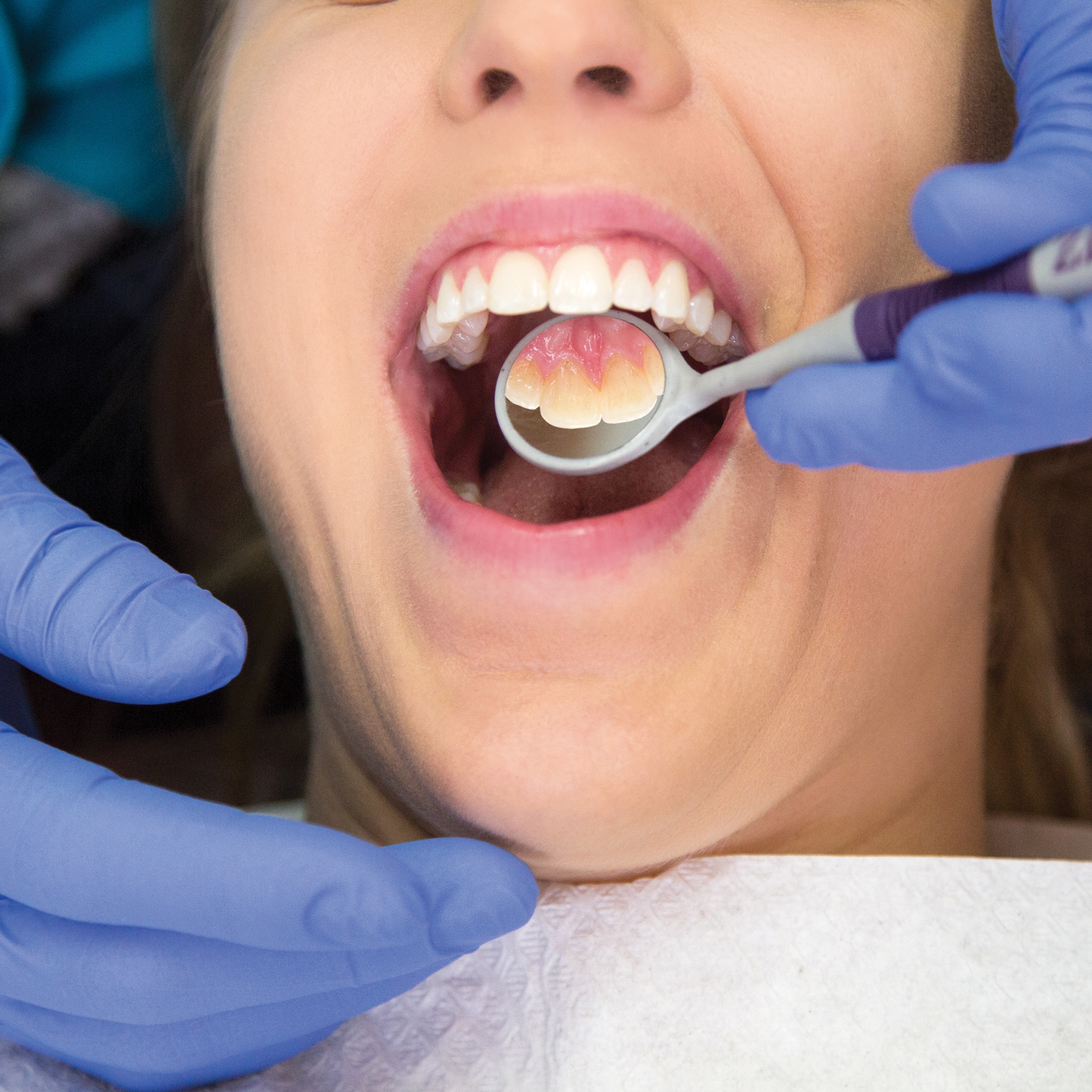 #5 Soft Grip - 12 Pack